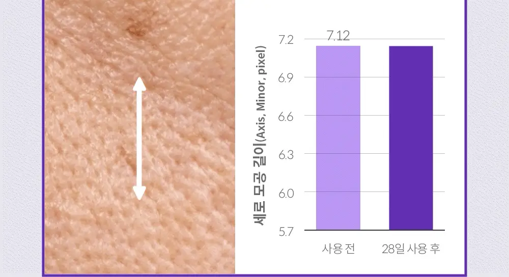 [휴닝카이PICK/모공케어] 더마펌 펩트올로지 부스팅 앰플 레티노이드 30ml 기획 (+30ml 리필) 상세페이지 30